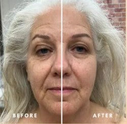 Mixzone™ Lymphatic Face Brush